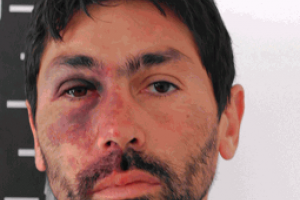 Tiene antecedentes  penales, robó, hirió a un policía y cumplirá arresto domiciliario